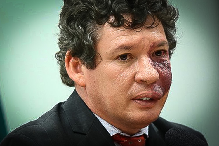STF pede à PGR que investigue Bolsonaro por ameaça a técnicos da Anvisa