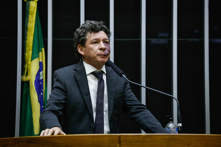 Lopes: Incompetência de Bolsonaro trouxe de volta a fome e a inflação