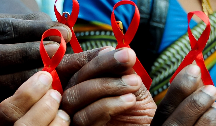 Com menos políticas públicas, Aids atinge mais negros no Brasil