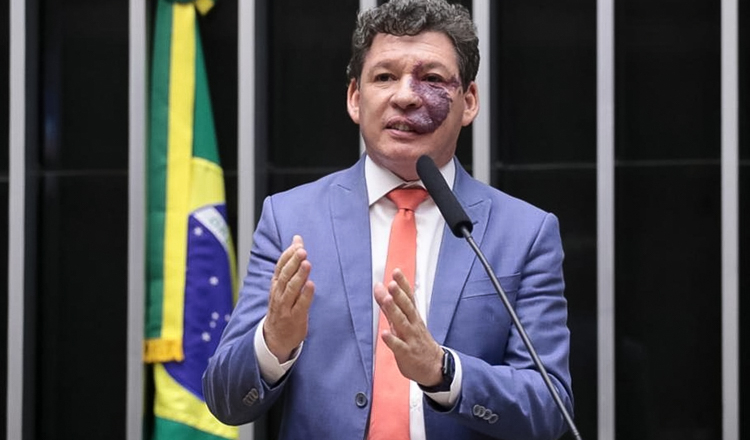 ‘A exploração da escala 6×1 vai acabar’